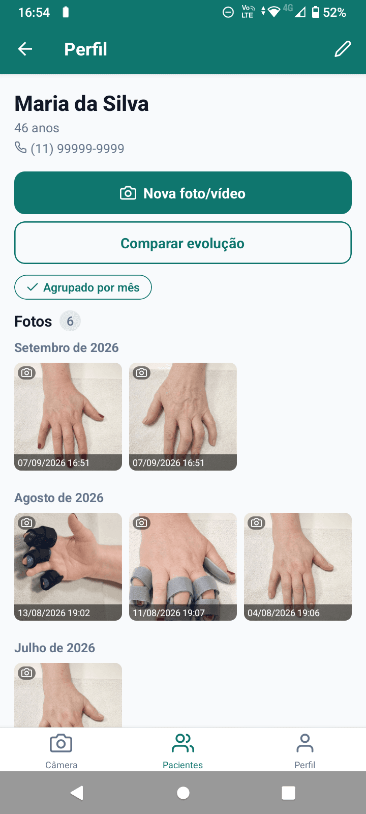 Galeria de evolução